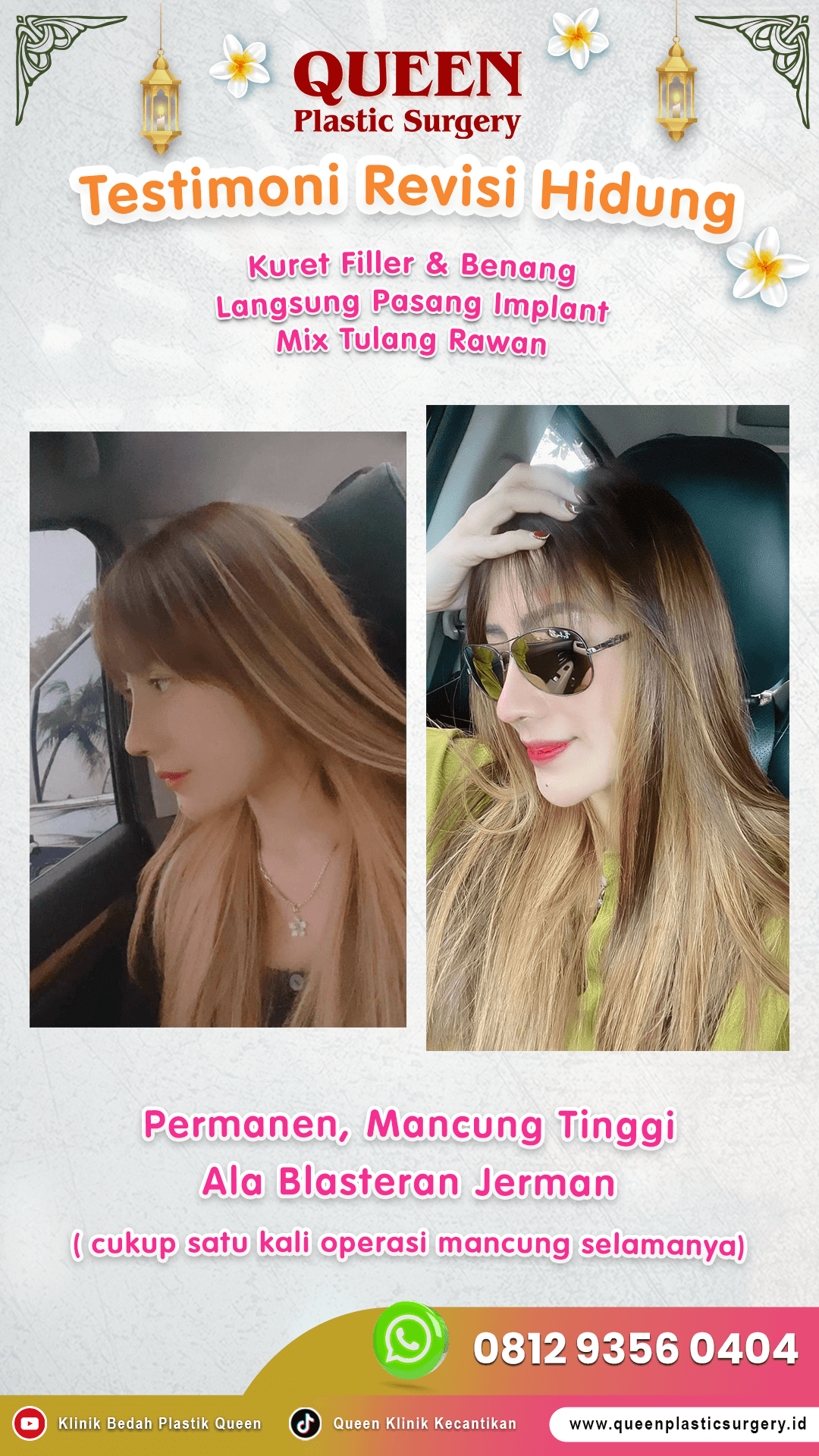 Testimoni-Revisi-Hidung
