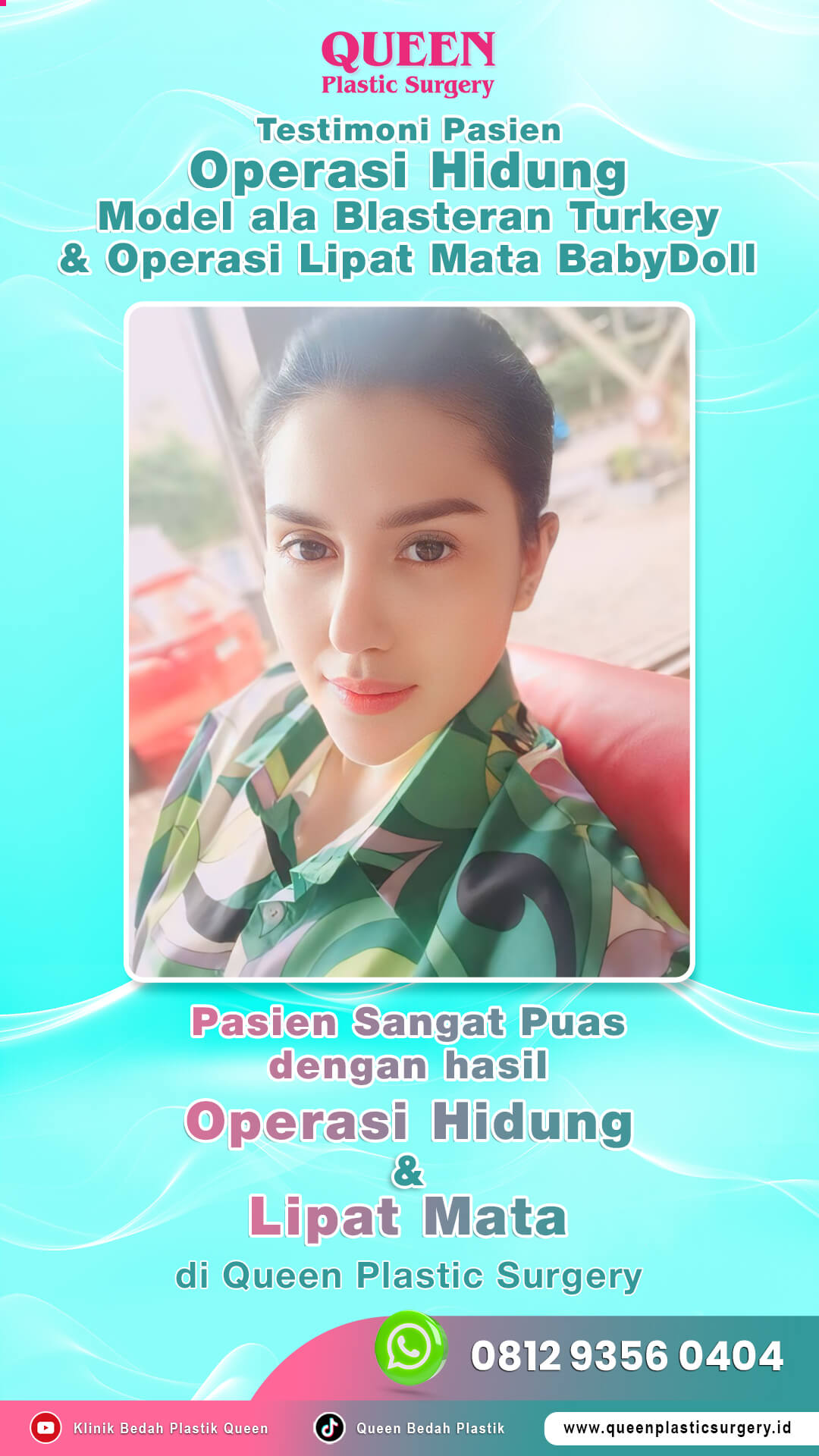 Testimoni_Pasien_Operasi_Hidung_Blasteran_Turkey_&_Lipat_Mata_Queen (1)