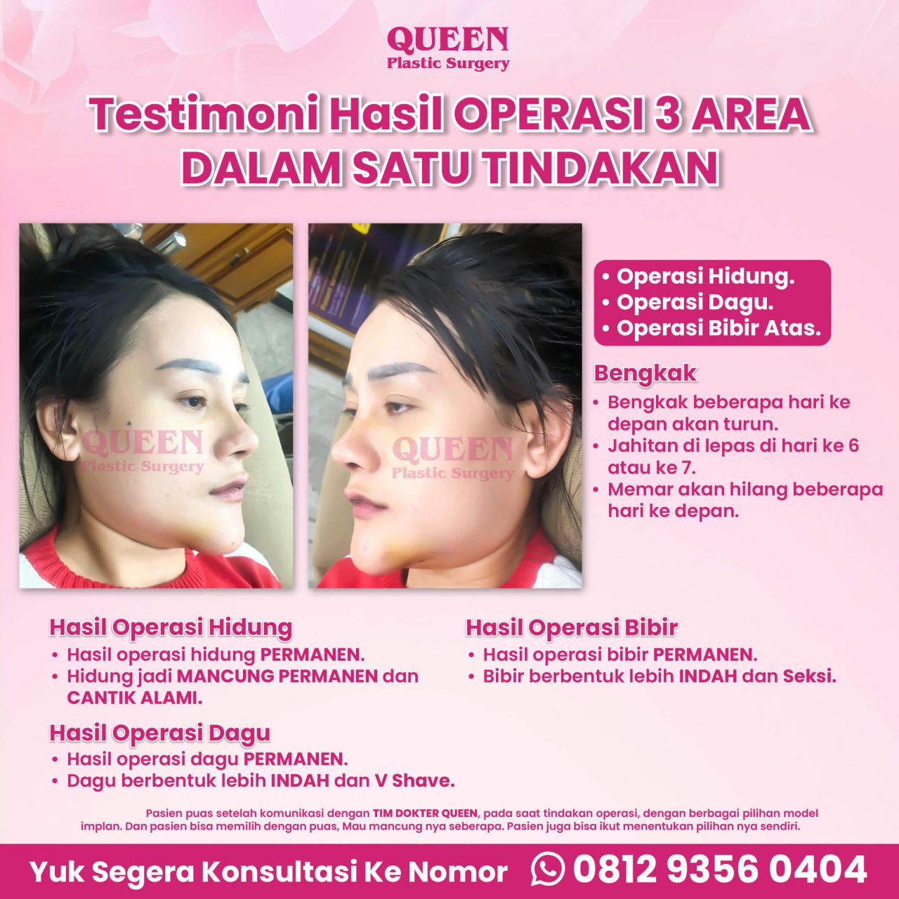 WEB TESTI PASIEN-03 (1) (1)