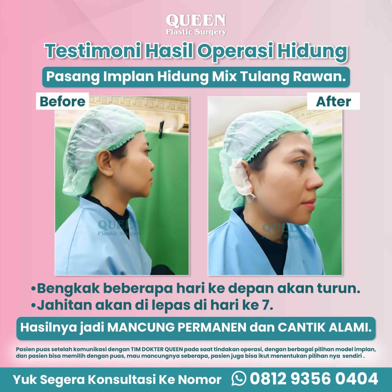 WEB TESTIMONI-03 (1)