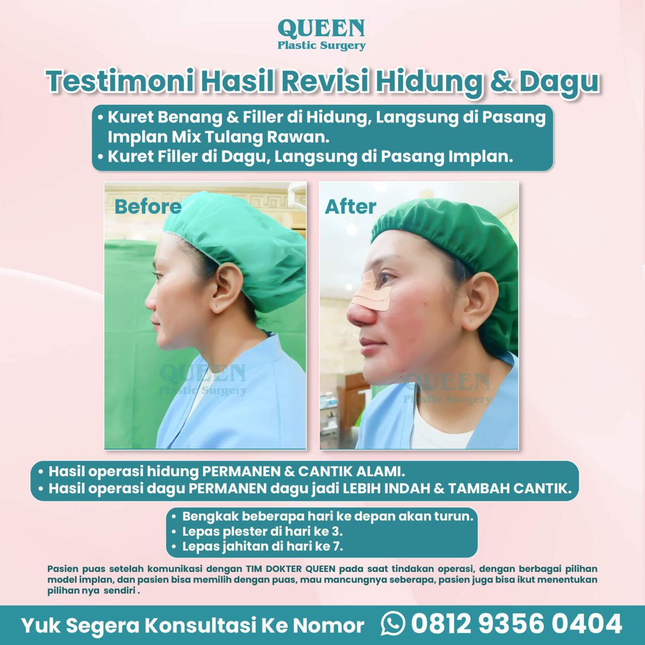 WEB TESTIMONI PASIEN-08 (1)