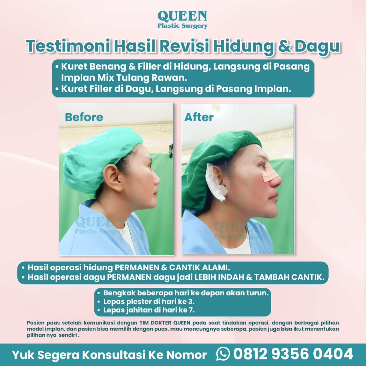 WEB TESTIMONI PASIEN-09 (1)