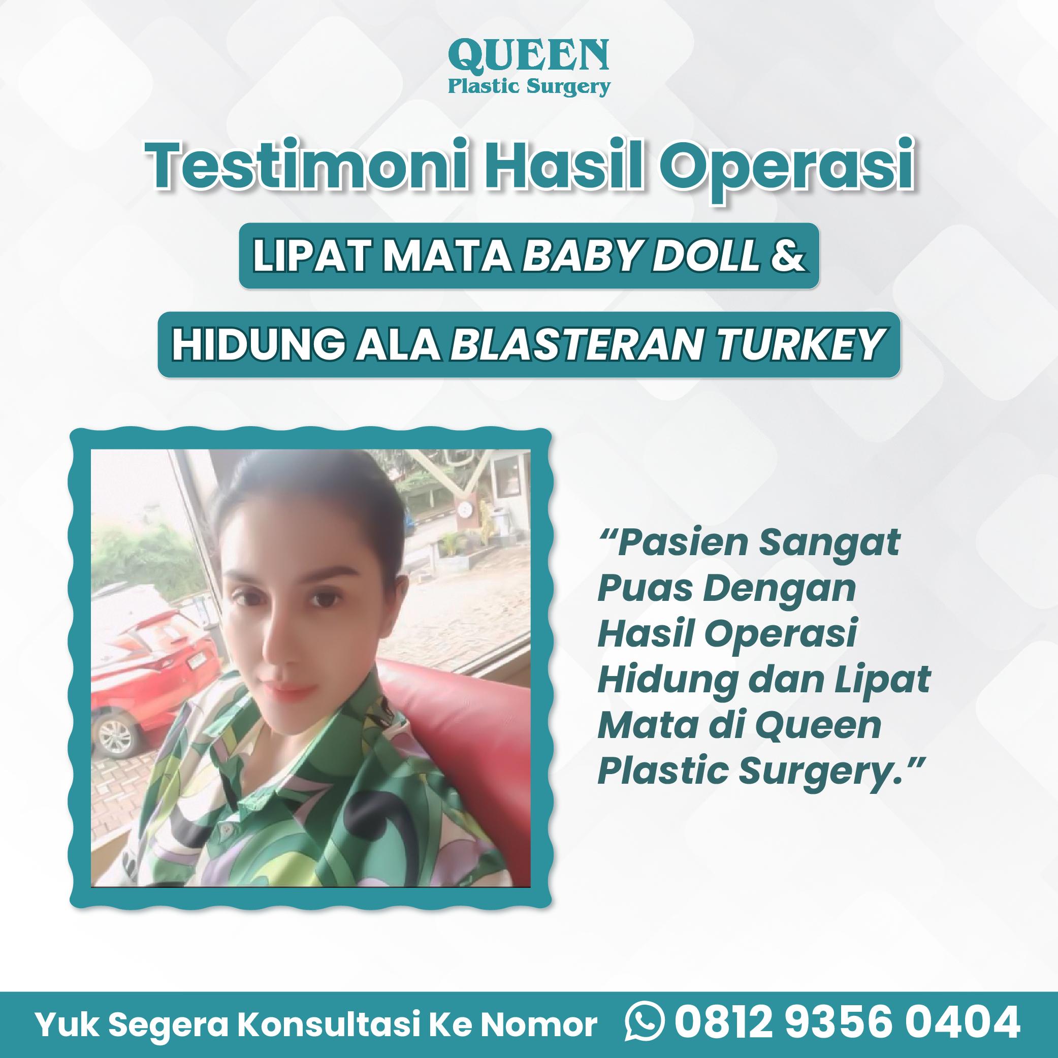 Dampak Alkohol Sebelum dan Sesudah Operasi Plastik: Pentingnya Memahami!