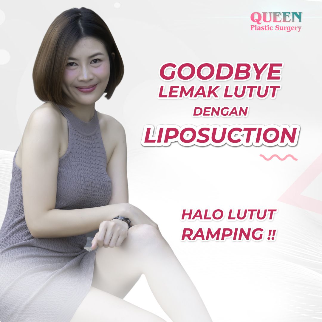 Liposuction Lutut Say Goodbye Lemak Lutut