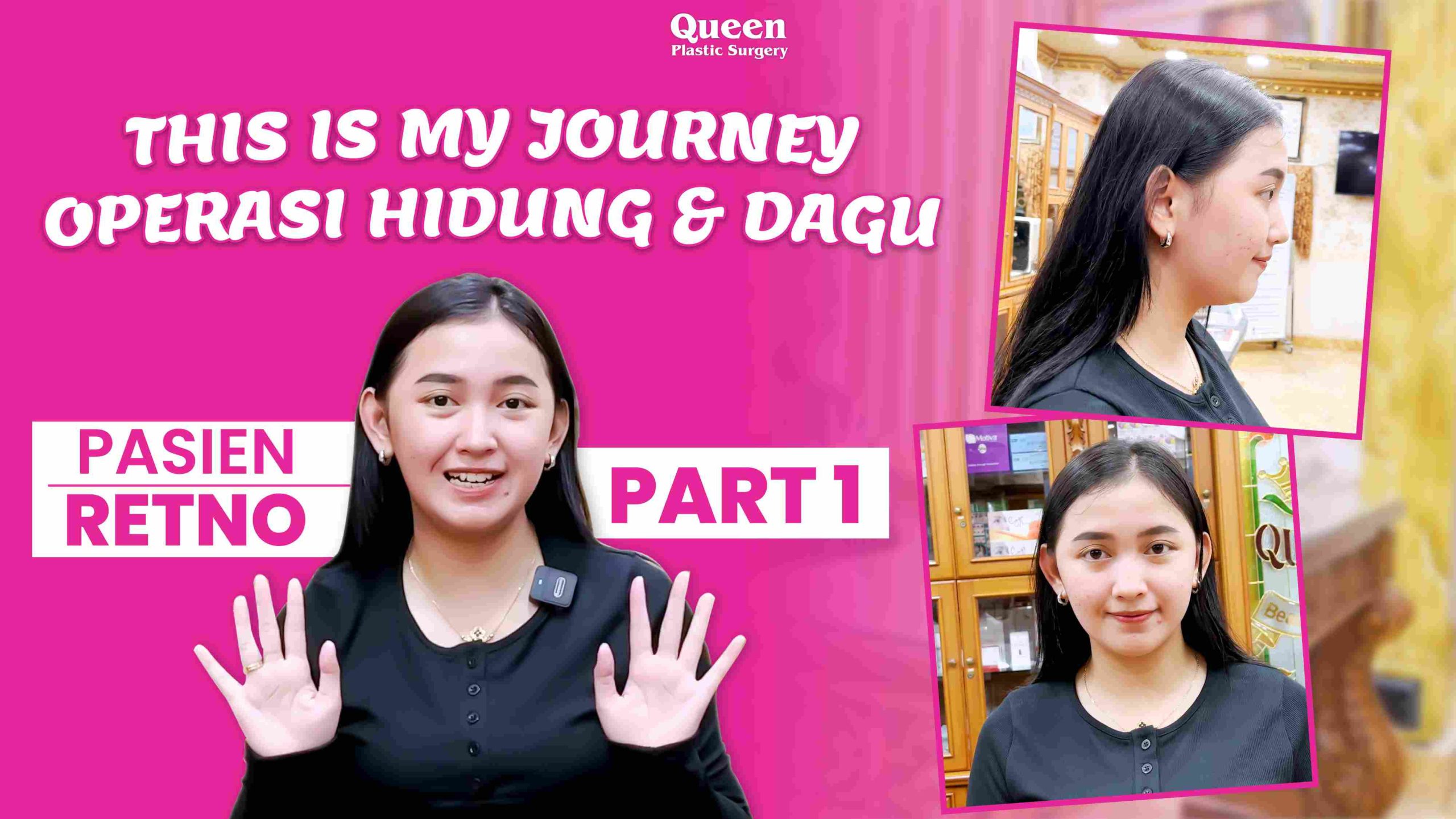 https://queenplasticsurgery.id/wp-content/uploads/2024/09/THUMBNAIL-4-.jpg