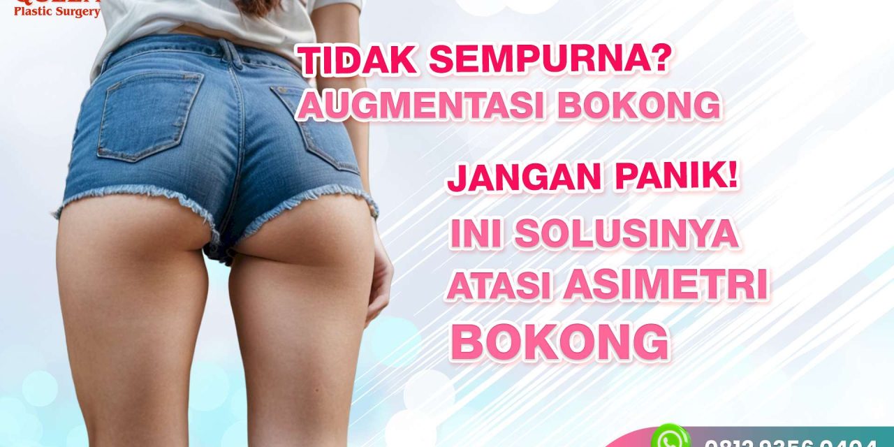 ASIMETRI BOKONG – Augmentasi Bokong Tidak Sempurna?