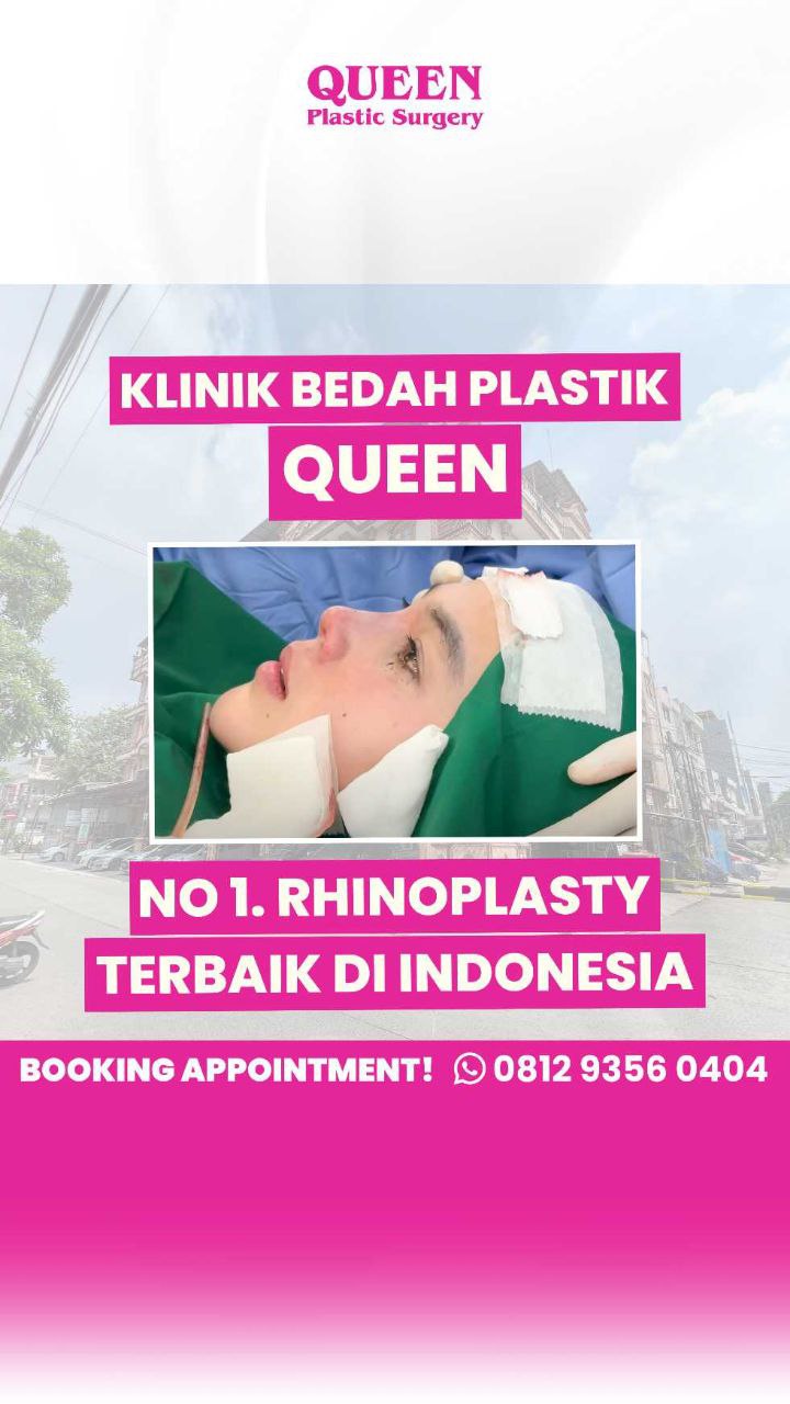 Hasil Rhinoplasty Queen Plastic Surgery, foto 67