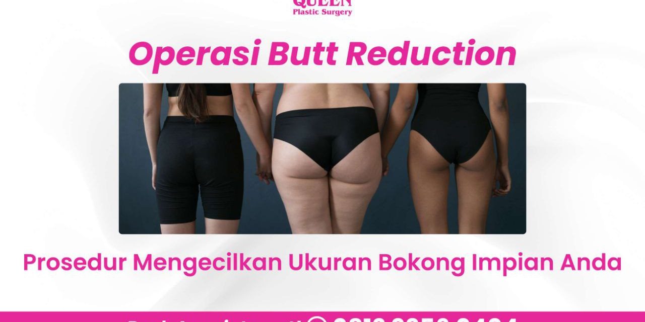 Butt Reduction Mengecilkan Ukuran Bokong Impian Anda