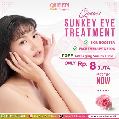 Queen's-Sunkey-Eye-Treatment